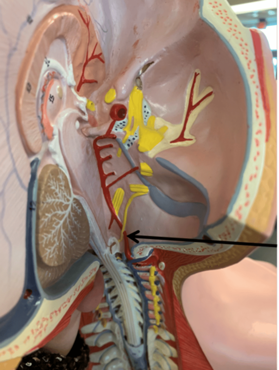 <p>Name the blood vessel.</p>