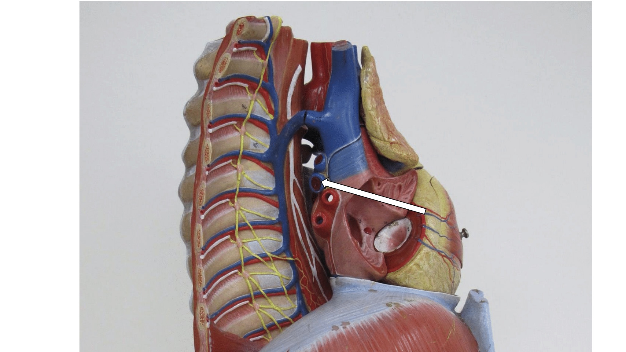 <p>Lateraal zicht mediastinum, bloedvat</p>