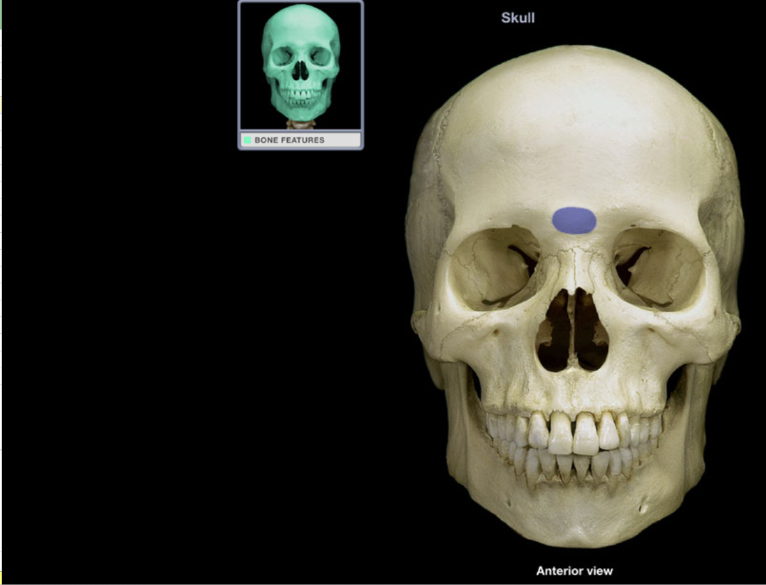 <p>Glabella</p>
