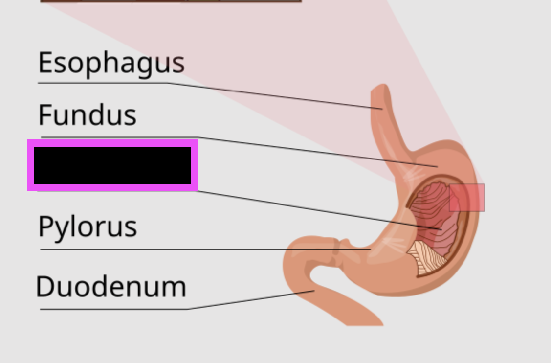 term image