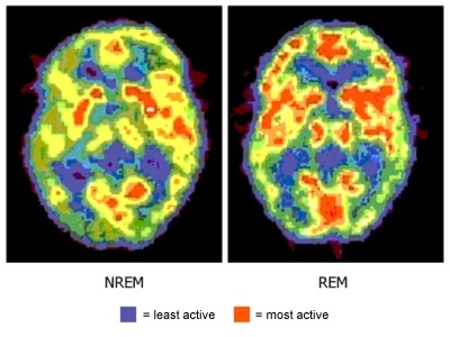 <p>Activation-Synthesis: In REM sleep, the brainstem is active and the cerebral cortex will later make sense of it. Dreams are a result of random firing in the brain.</p><p>Freud: The manifest content ("plot") has a hidden meaning (the latent content) to be interpreted to resolve hidden problems.</p>