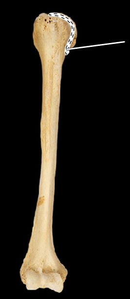 <p>Name the highlighted portion.</p><p>(Humerus, anterior view, right side).</p>