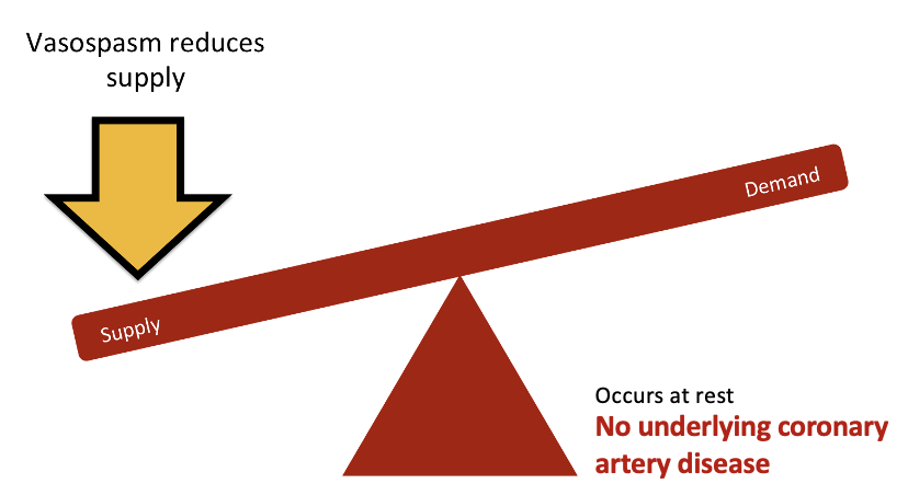 <ul><li><p>vasospasms reduces supply </p></li><li><p>occurs at rest</p></li><li><p>there is no underlying coronary artery disease</p></li></ul><p></p>