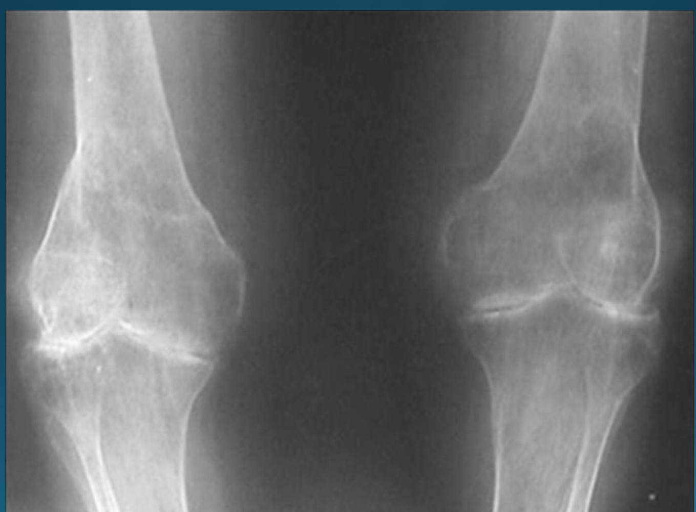 <p>what is the diagnosis </p>