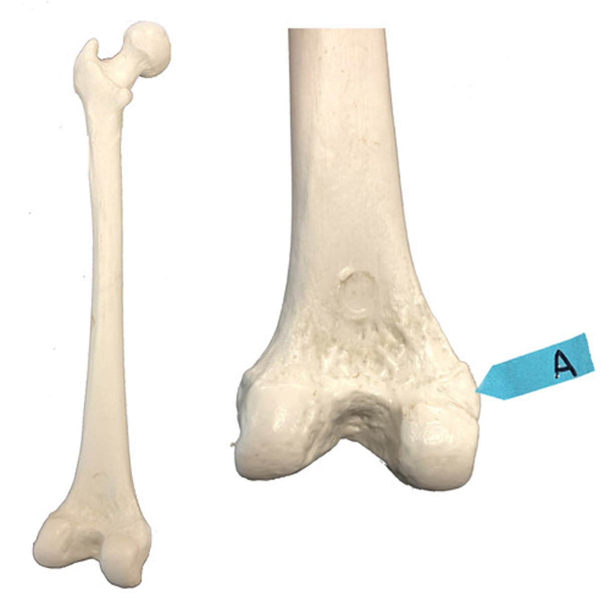 <p>Identify this bone marking.</p>