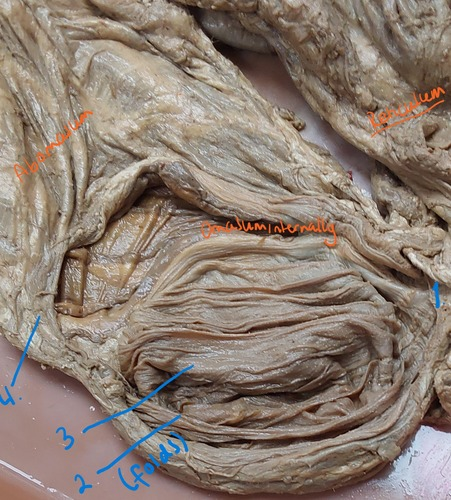 <p>2nd flashcard on structures of omasum (same)</p>