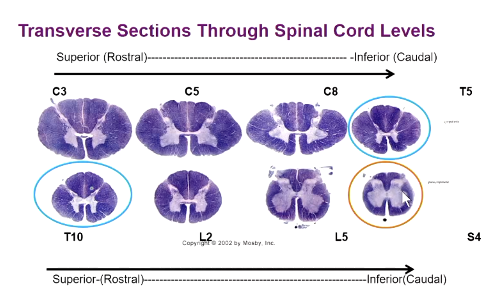 <p>no bulge but also central part between dorsal and ventral (similar location to sympathetic neurons)</p>