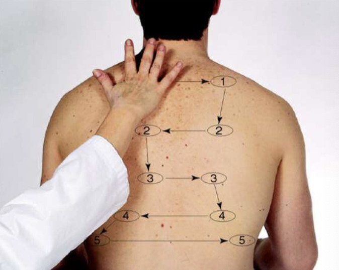 <ul><li><p>Use palmar base of fingers or ulnar edge, touch chest while patient says “ninety-nine”</p></li><li><p>Start over apices and palpate from side to side to make a comparison </p></li><li><p>Normal finding: symmetrical vibrations </p></li><li><p>HOT TIP: the vibrations of sounds are conducted BETTER through a DENSE OR SOLID structure than a porous one so <u>anything that increases density of lung will increase fremitus</u></p><ul><li><p>Hear it louder over tumor </p></li><li><p>Air = porous </p></li></ul></li></ul><p></p>