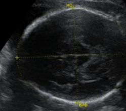 <p>which measurement is the one going horizontally over the image?</p>