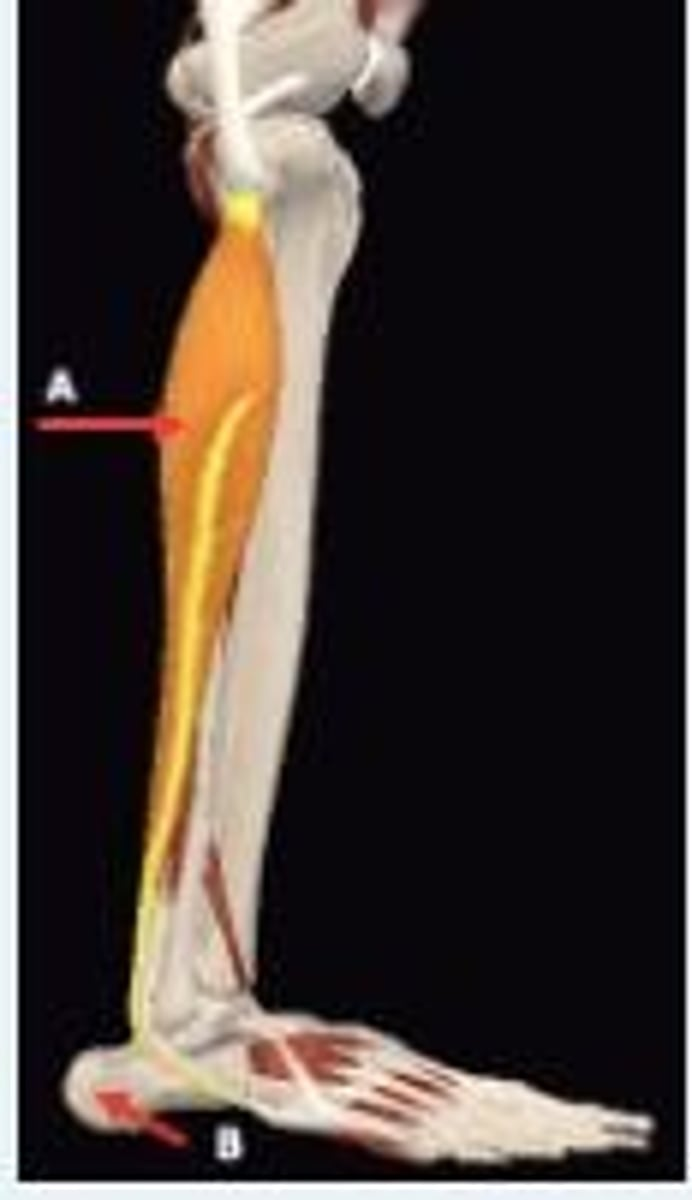 <p>The label A represents ___ ___ muscle. It acts on ___ joint and moves the foot into the position of ___ movement of the foot. The B represents the heel bone called ___.</p>