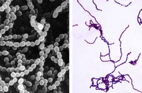 <p>Genus: Streptococcus</p>