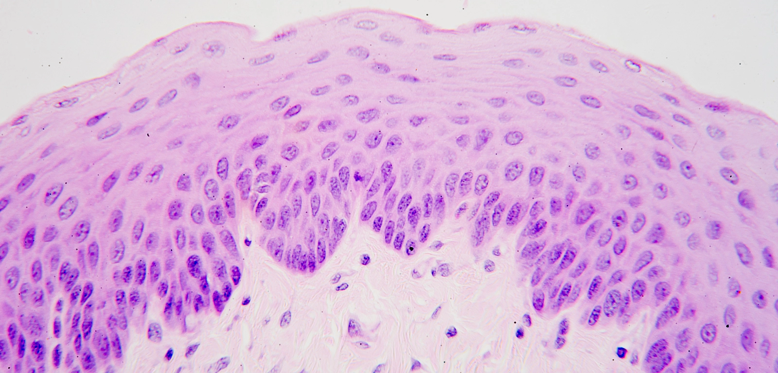 <p>Location and function of stratified squamous, non keratinized epithelial cells</p>