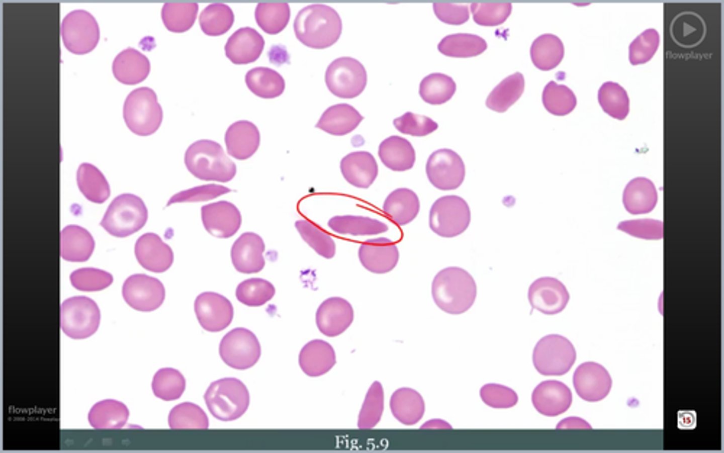 <p>wtf rbc2? cause?</p>