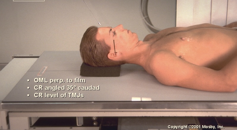 <p>What position is this?</p>