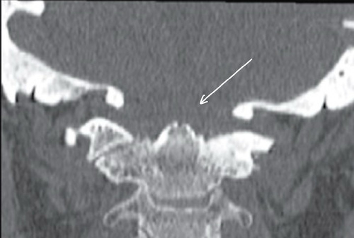 <p>What condition is this?</p>