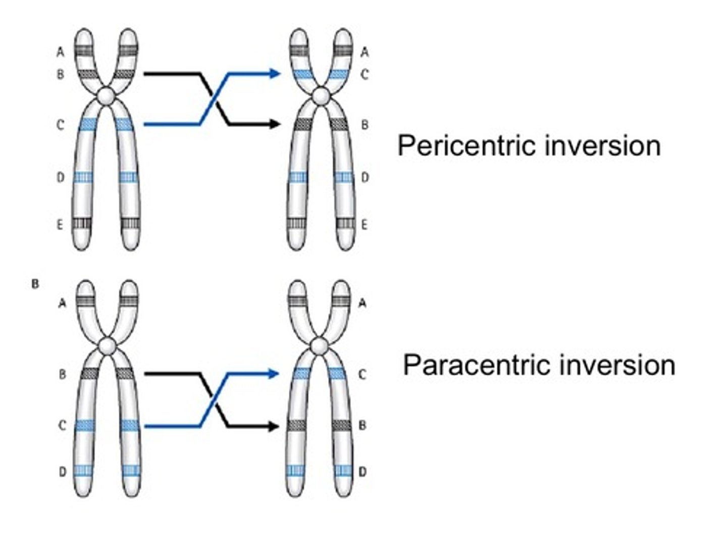 <p>An inversion in which the centromere is found outside of the inverted region.</p>