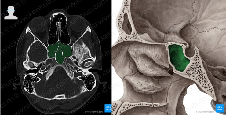 <p>En el cuerpo del esfenoides</p><ul><li><p>Drena al receso esfenoetmoidal, un área encima del meato superior</p></li></ul><p></p>