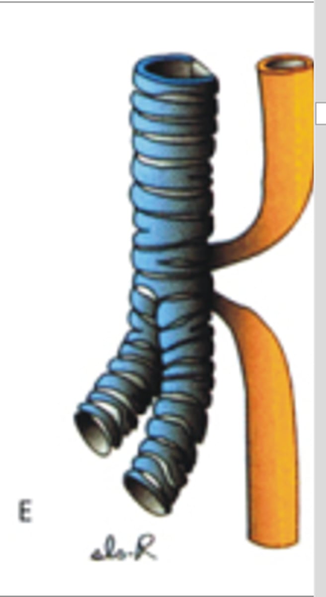 <p>Hoe heet dit type anomalie thv de slokdarm?</p>