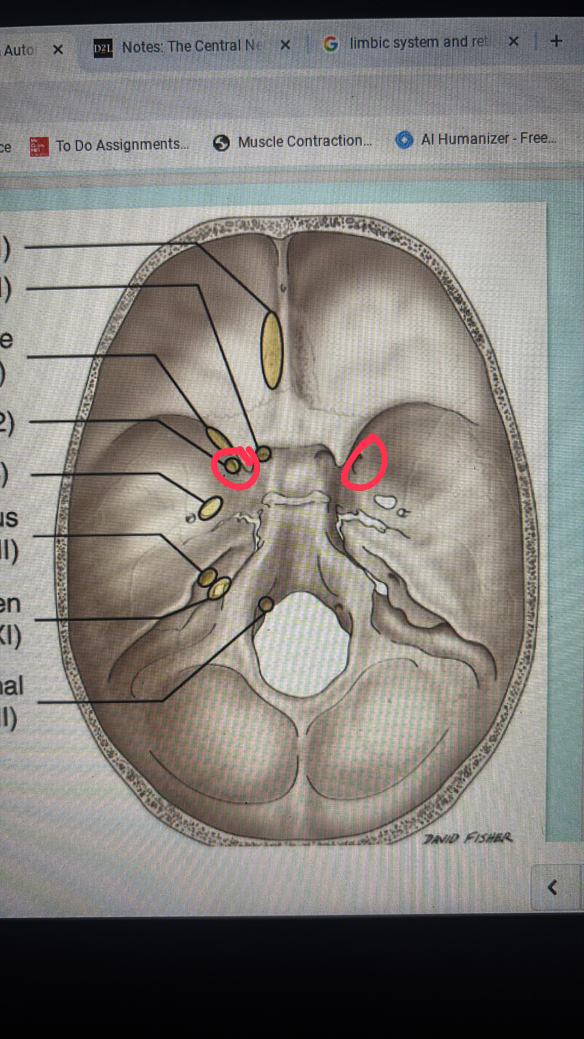 <p>maxillary division</p>