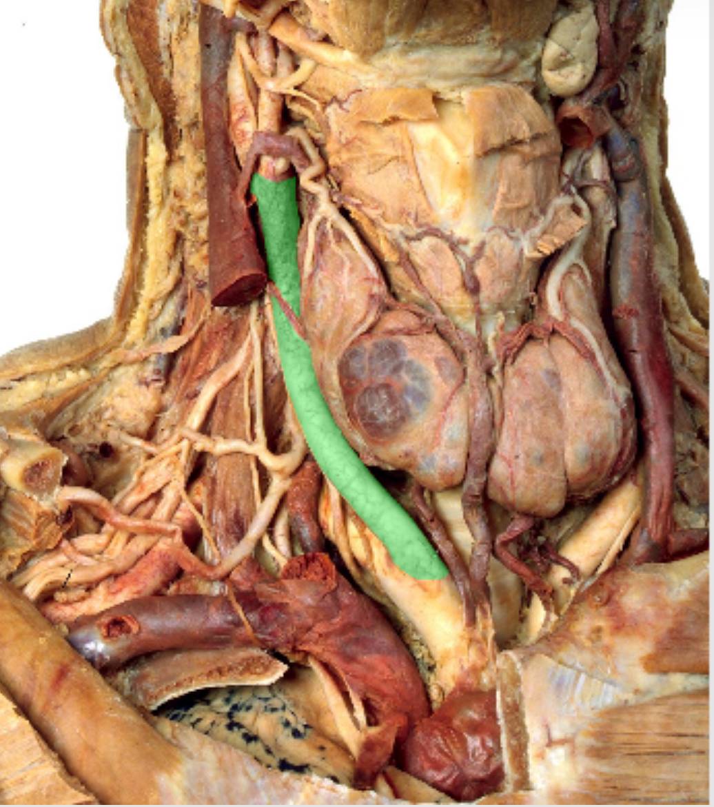 <p>Which artery?</p>