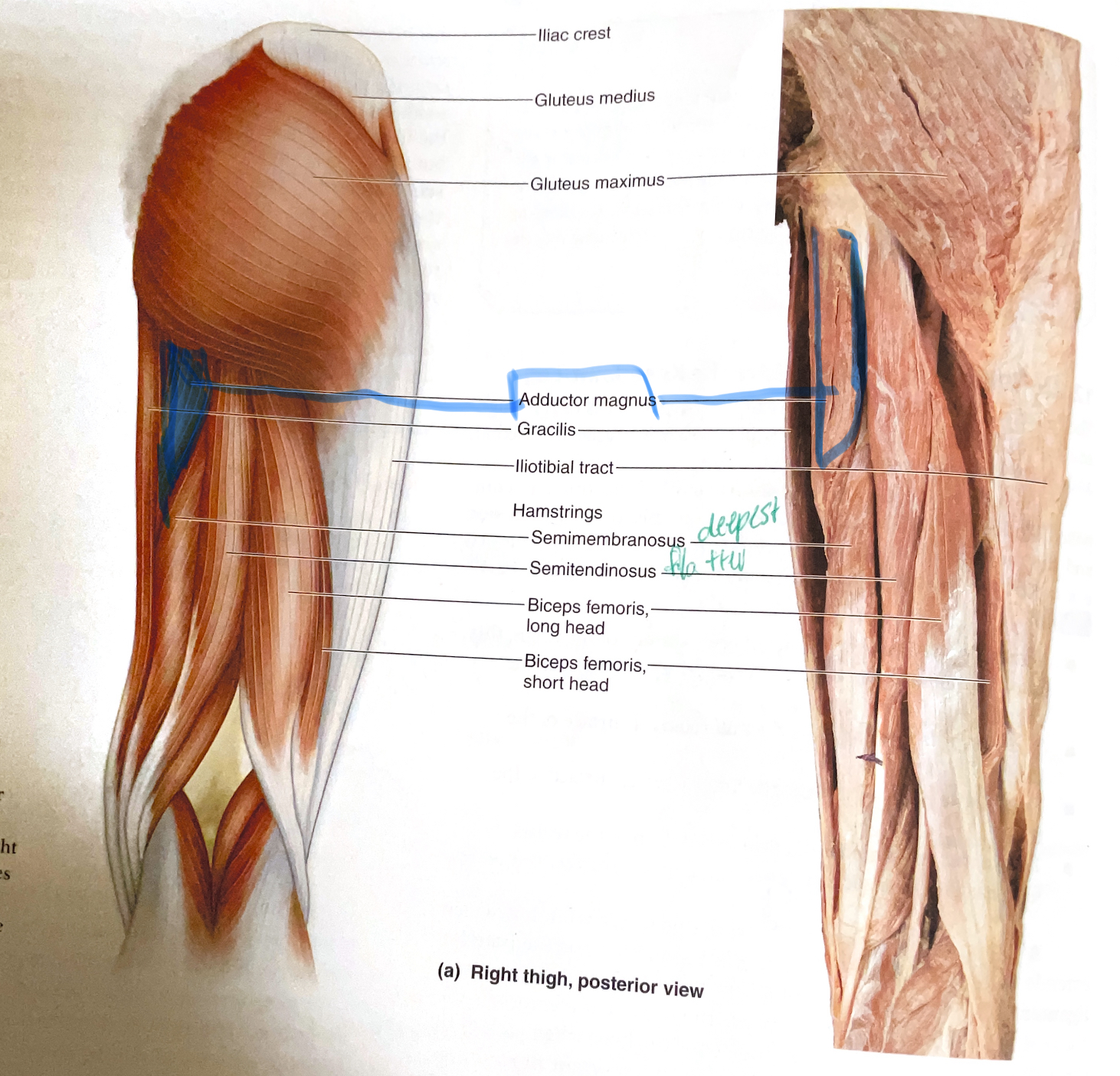 <p>Origin: Inferior pubic ramus, ischial ramus, and ischial tuberosity</p><p>Insertion: Linea aspera(<span>roughened ridge on the posterior (back) surface of the femur)</span></p><p>Action:Adduct, flex hip</p>