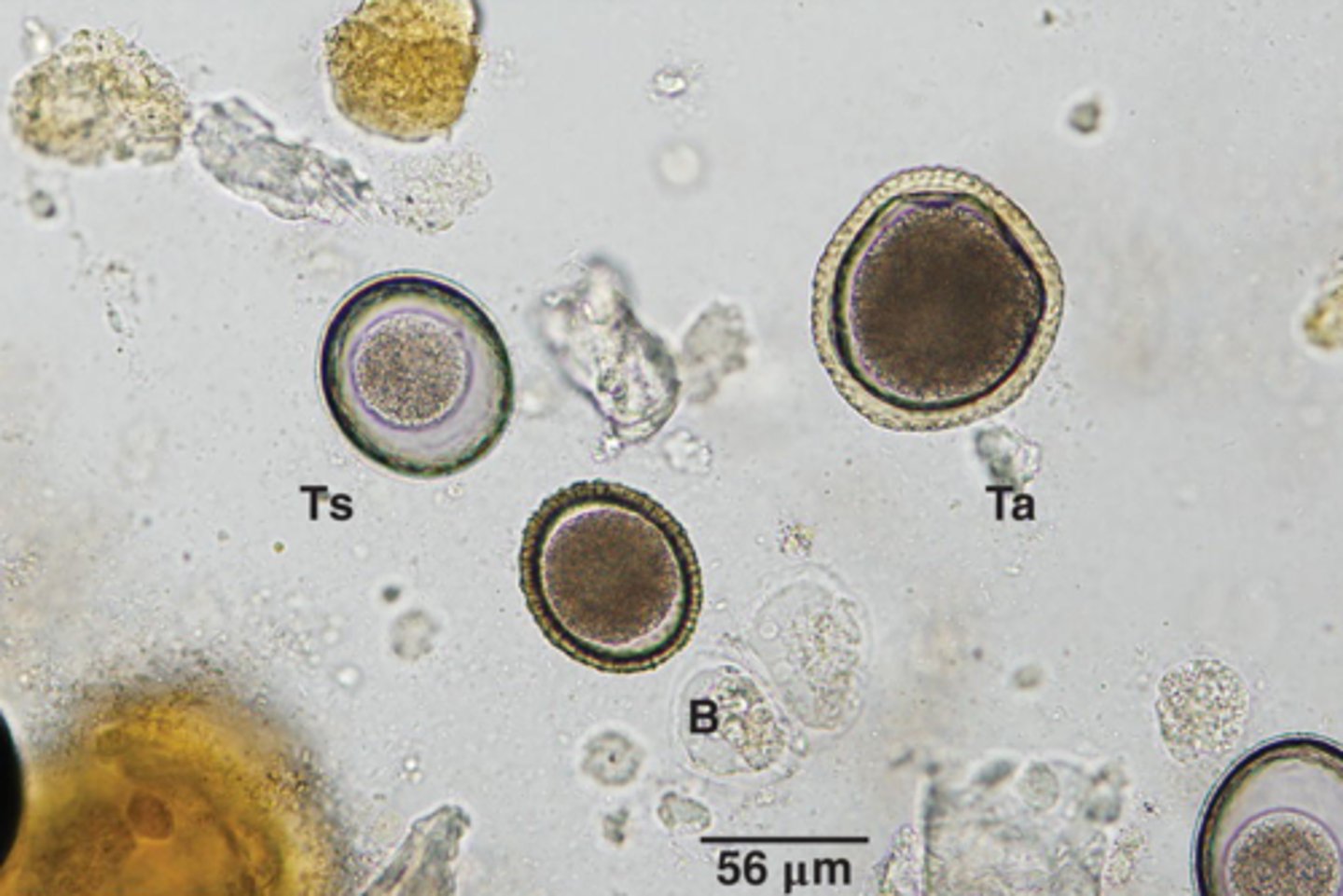 <p>What parasite is Ts if it is from a cat</p>