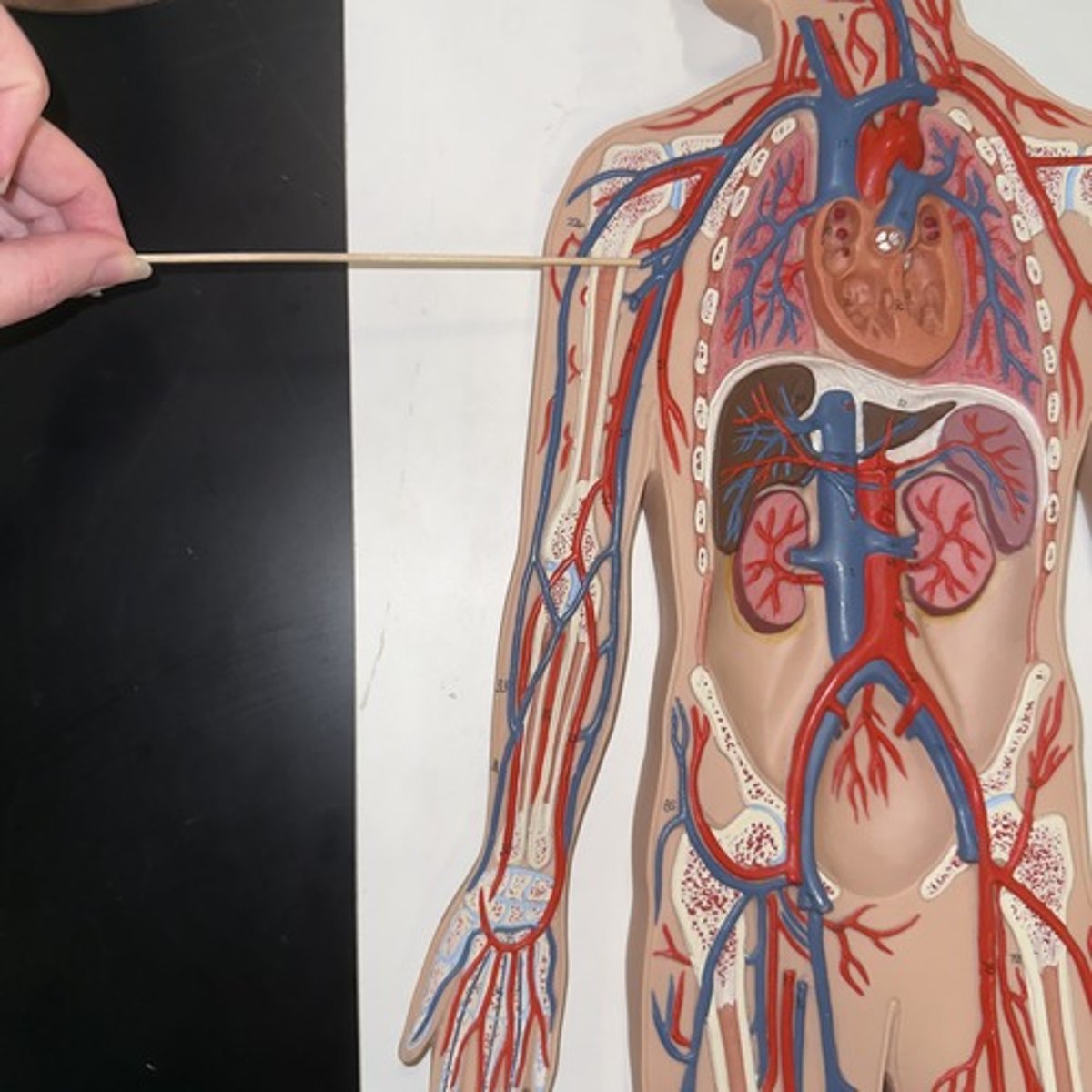 <p>Identify the structure.</p>