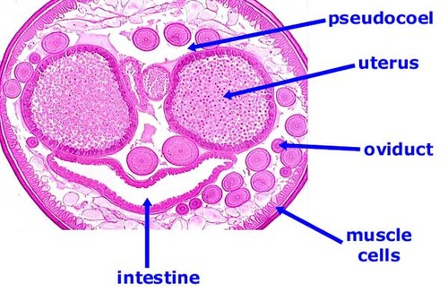 <p>roundworm cross section</p>