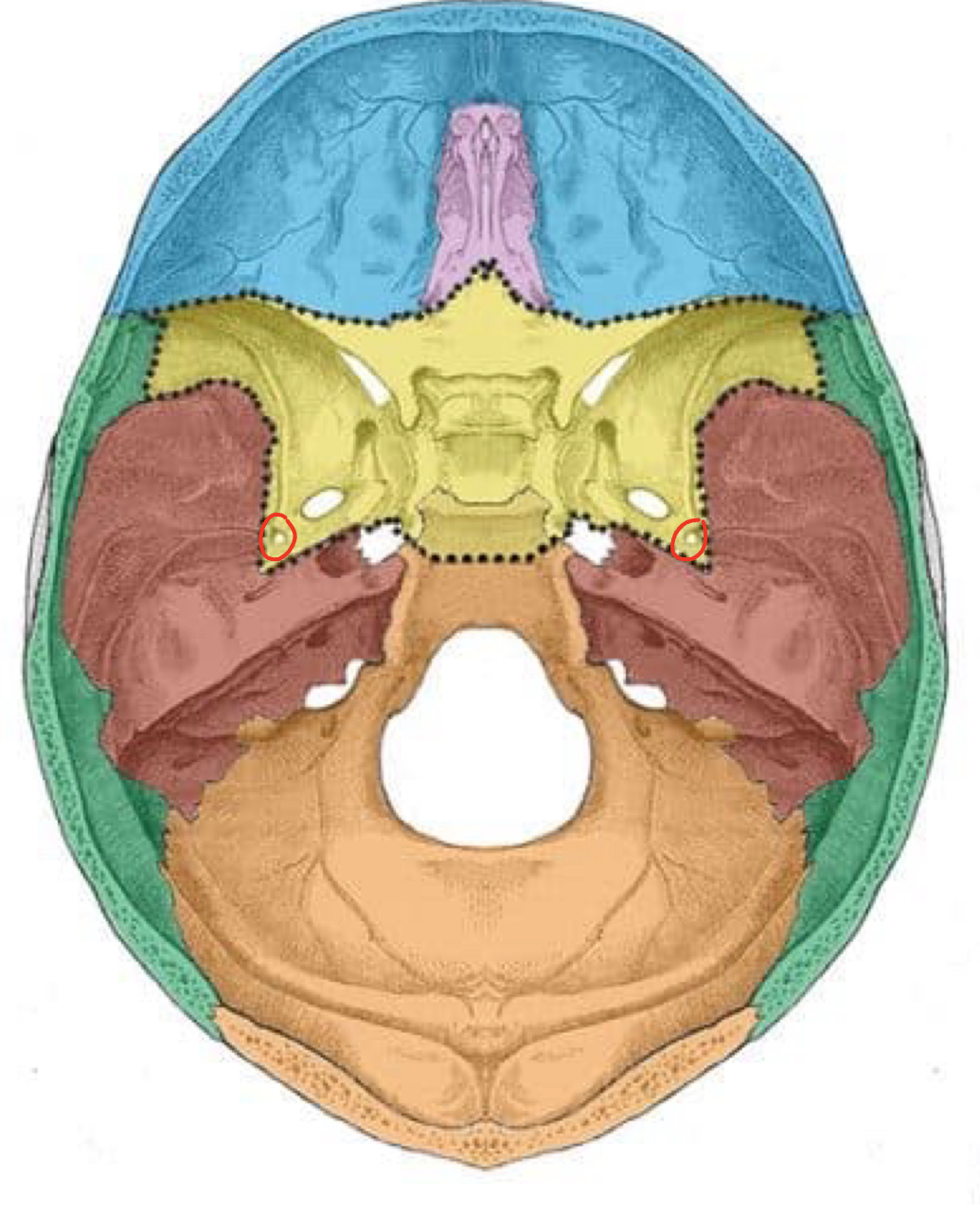 term image
