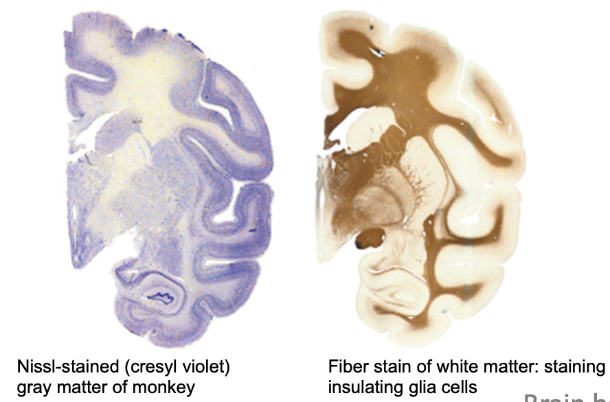 <ul><li><p>nissel: darker stains = grey matter, nucleic acids in rough ER, cell bodies</p><ul><li><p>Best for seeing cell bodies, neuro-degeneration, neuron density</p></li></ul></li><li><p>fibre: darker stains = white matter, binds to myelin, won’t show whole cells</p><ul><li><p>Best for seeing white matter and nerve fibres</p></li></ul></li><li><p>golgi: darker stains = neurons and dendrites </p><ul><li><p>Best for seeing the entire neuron</p></li></ul></li></ul><p></p>