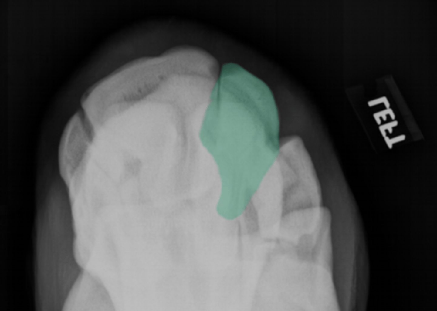 <p>What bone is highlighted?</p>