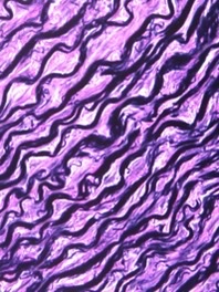 <p>What fiber is seen here in Verhoeff’s stain?</p>