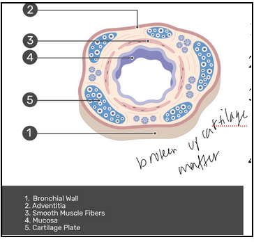 <ul><li><p><span style="background-color: transparent;"><span>Contains</span></span></p><ul><li><p><span style="background-color: transparent;"><span>Mucosa: respiratory epithelium</span></span></p></li><li><p><span style="background-color: transparent;"><span>Submucosa: seromucous glands</span></span></p></li><li><p><span style="background-color: transparent;"><span>Cartilage: 16-20 rings, maintains patency of tube (prevents collapse)</span></span></p></li><li><p><span style="background-color: transparent;"><span>Adventitia: loose connective tissue</span></span></p></li></ul></li></ul><p></p>
