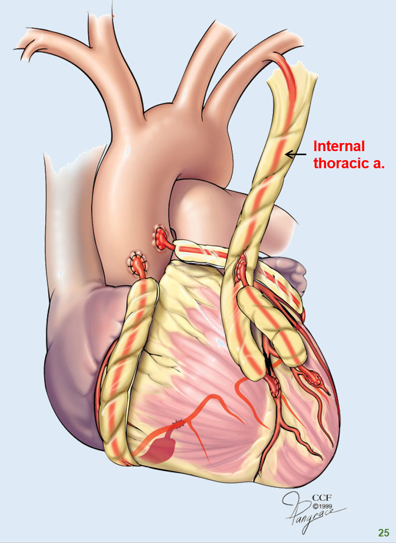 <p>It has a <strong>good blood supply</strong> and remains open longer than vein grafts, making it a preferred choice for bypassing <strong>blocked coronary arteries</strong>.</p>