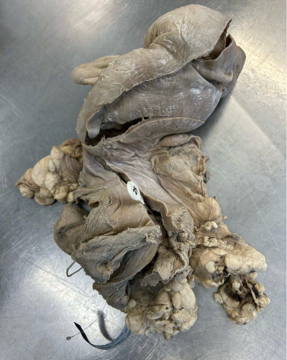 <p>What is the parent of the artery that supplies this region?</p>