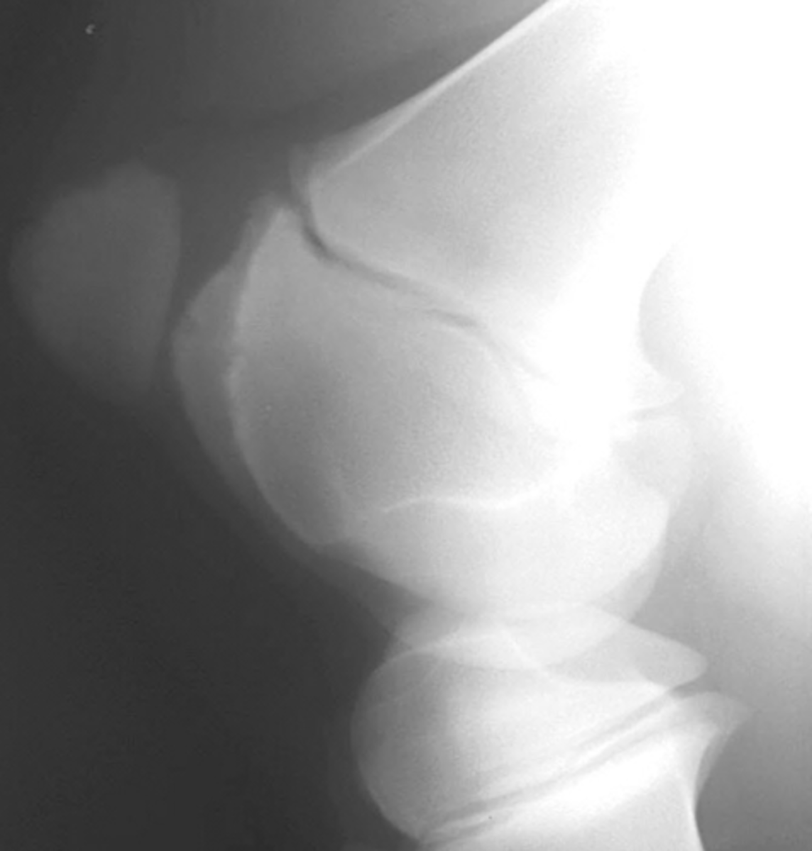<p>What is the problem w/ this radiograph?</p>