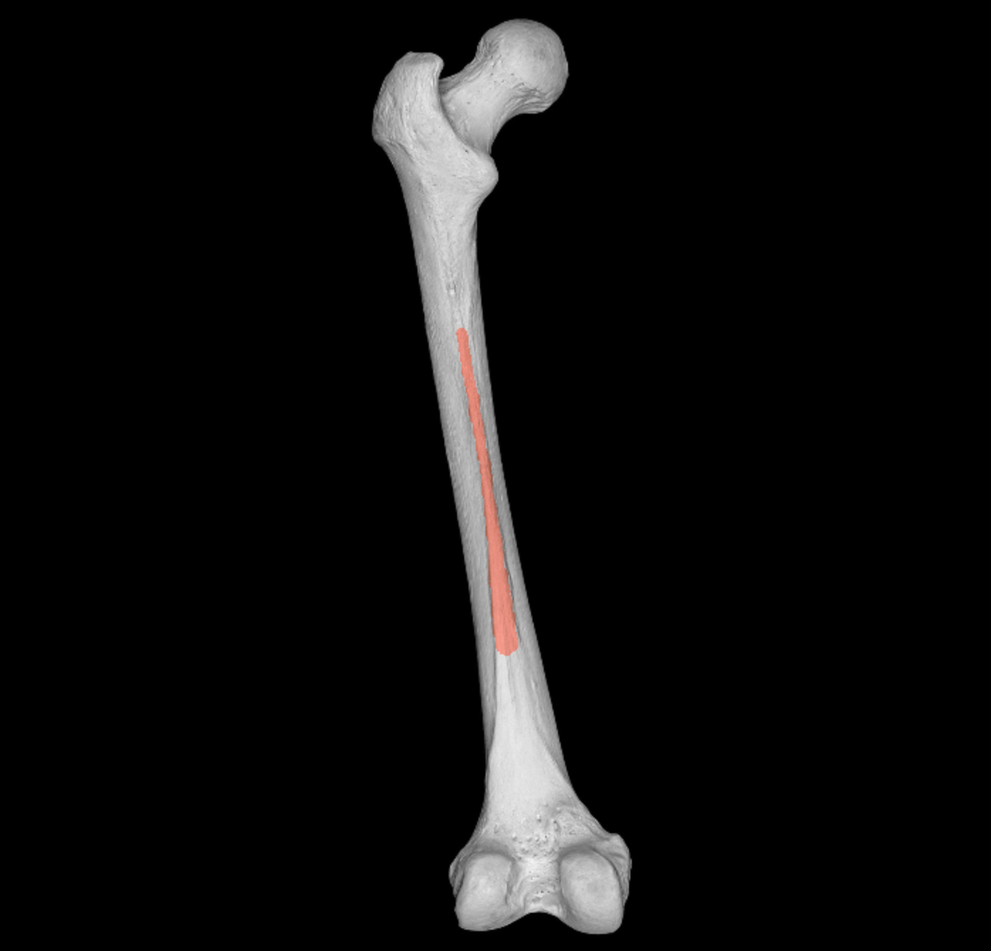 <p>most prominent border of femur</p><p></p><p>posterior</p>