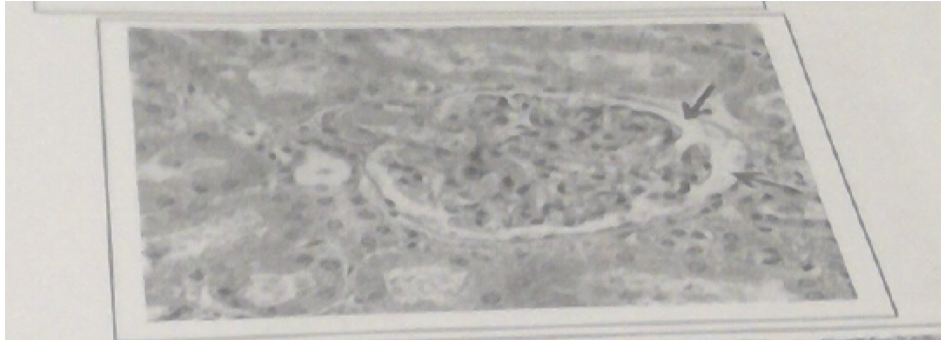 28\. The structure indicated by the arrows