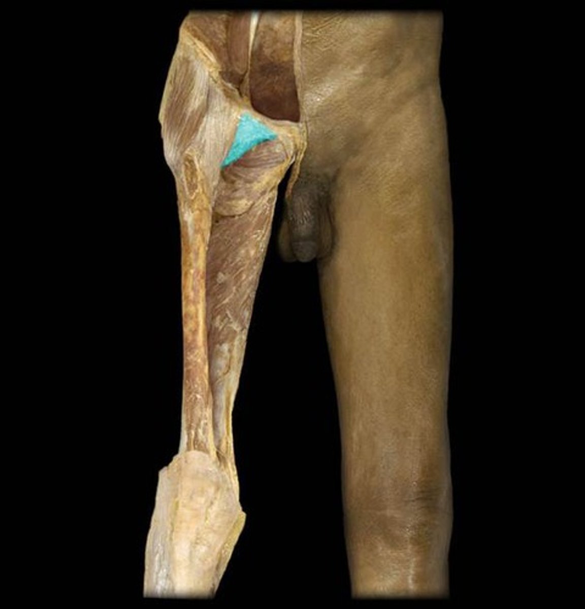 <p>Name this connective tissue structure.</p>