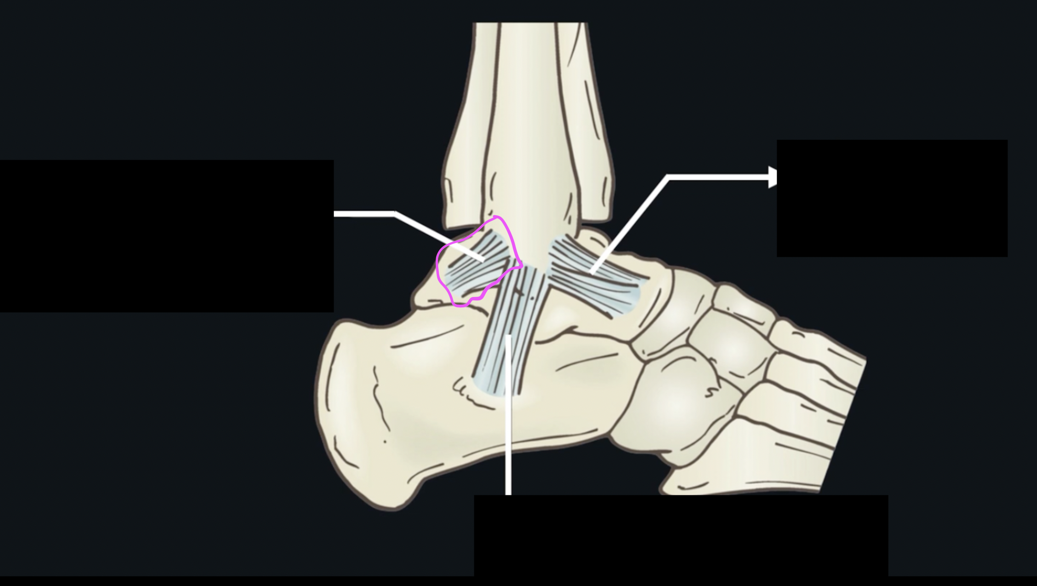 <p>What ligament is this? </p>