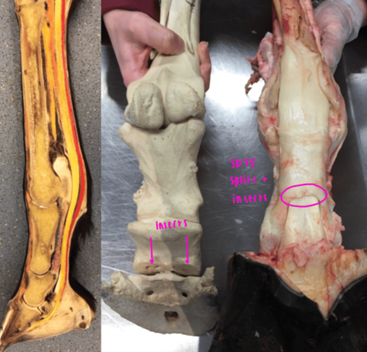 <p>*Both located on the palmer aspect*</p><p>Superficial digital flexor tendon</p><p>- Subcutaneous and palpable</p><p>- At distal end of P1 and inserts on P2</p><p>- Forms a sleeve around DDTF at proximal sesamoids (manica flexoria)</p><p>- Flexes the whole digit and stabilises the fetlock</p><p>Deep digital flexor tendon</p><p>- Runs deep to SDFT</p><p>- Passes through manica flexoria</p><p>- Inserts on flexor tuberosity of distal phalanx of each functional digit</p>