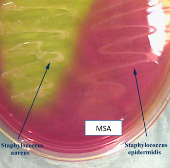 <p>Mannitol salt agar (MSA)</p>