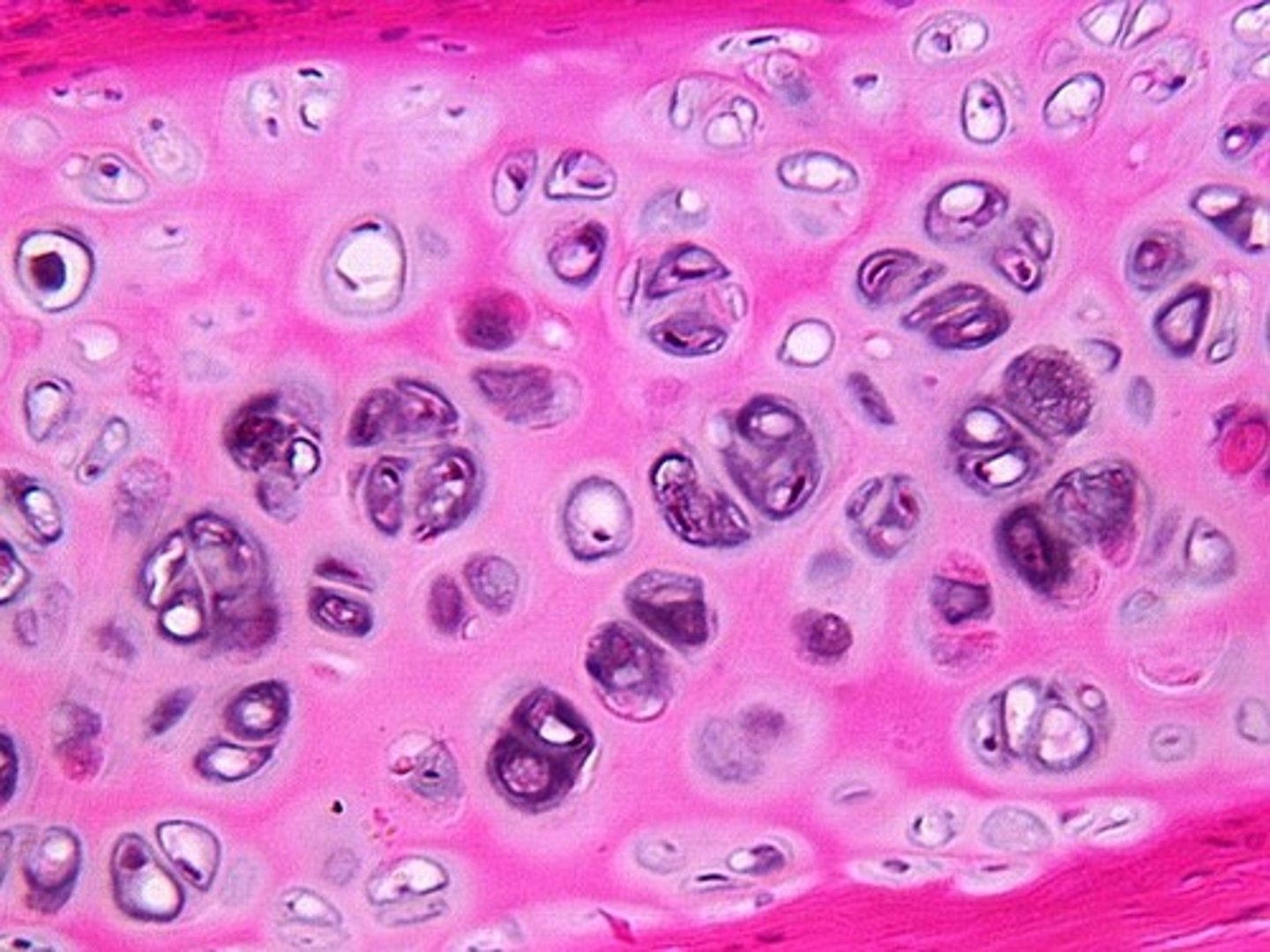 <p>cells sit in a lacuna.</p><p>found within joints</p><p>function: reduce friction that might occur within a joint</p>