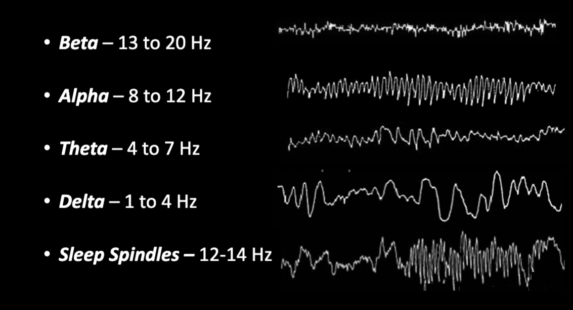 <p>Defined by frequency</p><ol><li><p>Beta - 13 to 20 Hz</p></li><li><p>Alpha - 8 to 12 Hz</p></li><li><p>Theta - 4 to 7 Hz</p></li><li><p>Delta - 1 to 4 Hz</p></li></ol><p>Sleep spindles - 12 to 14 Hz&nbsp;</p><p></p>
