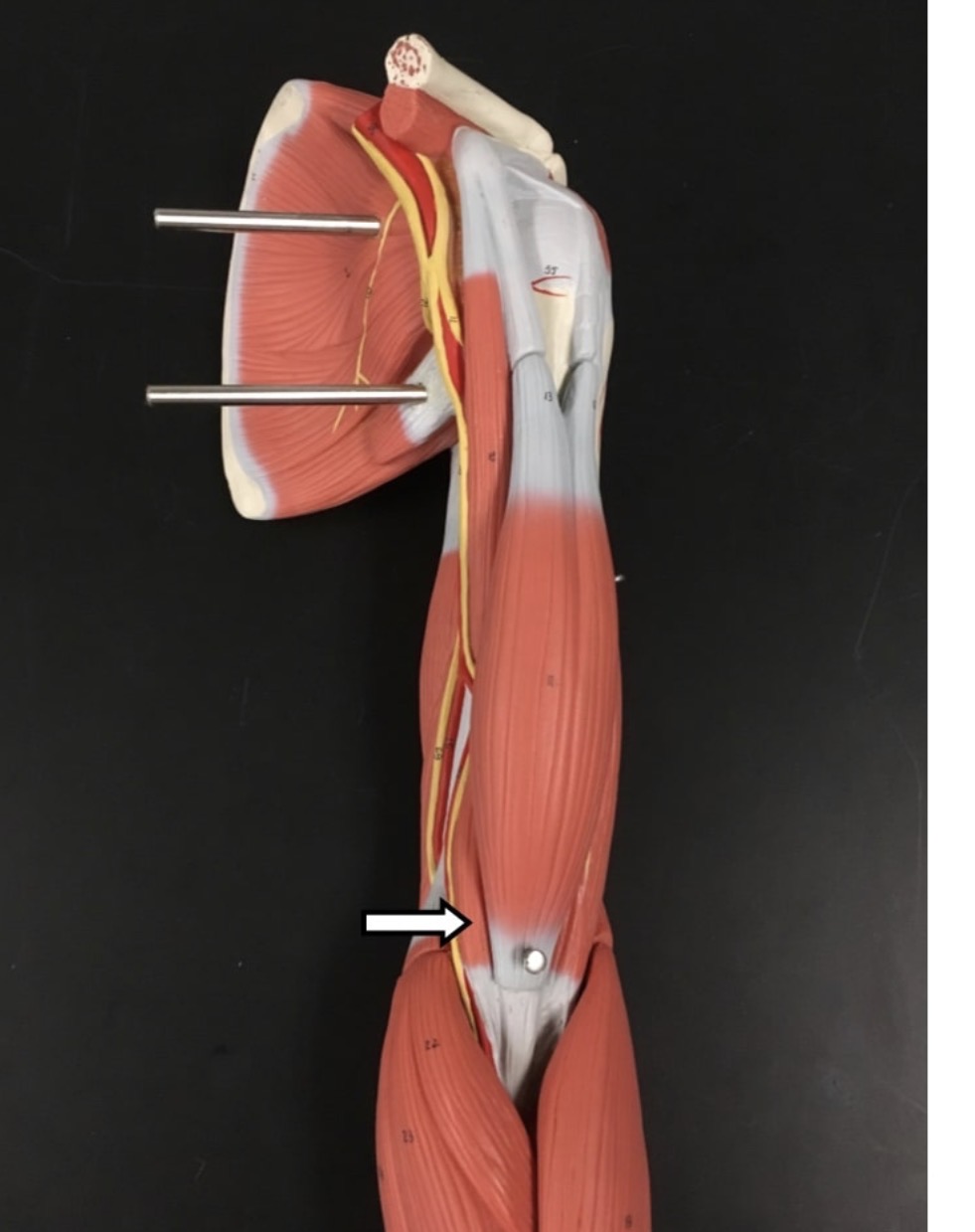<p><span>Name the muscle labeled with the white arrow below AND name the origin</span></p>