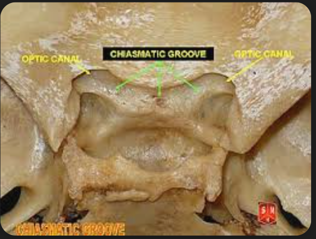 <p>Chiasmatic groove</p>