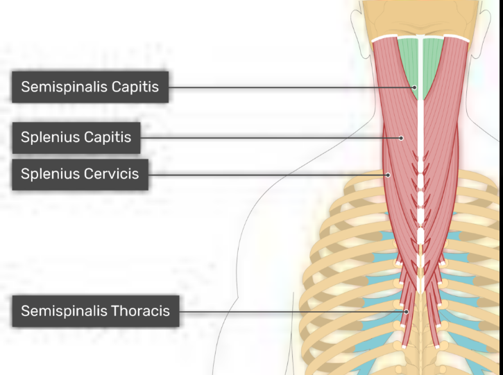 <p>Semispinalis </p>