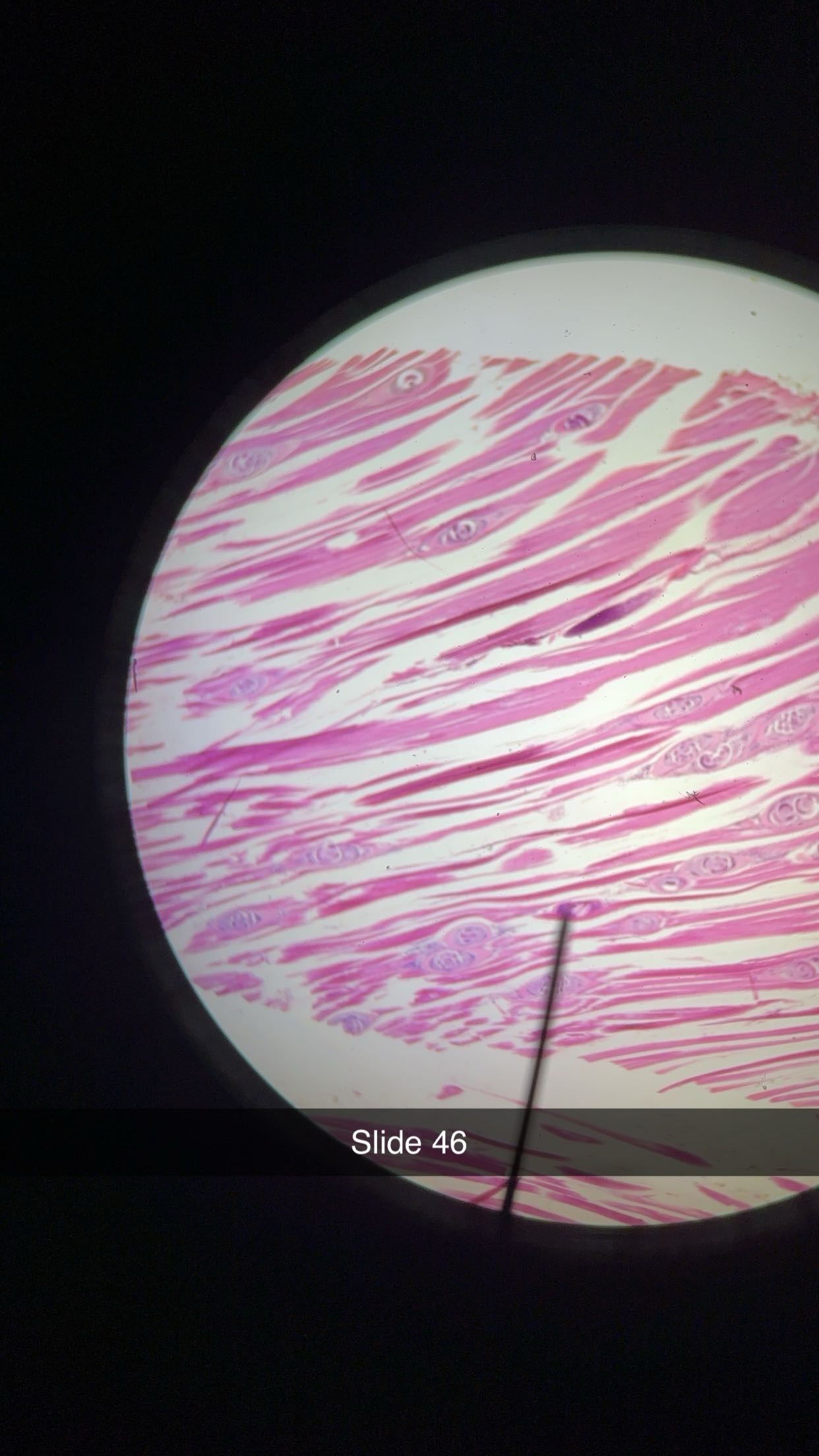 <p>genus, phylum, illness  </p>