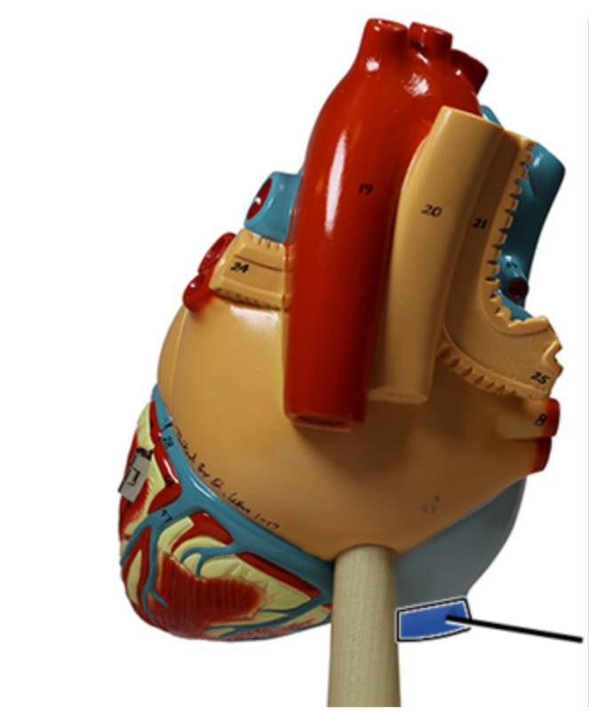 <p>Name this vein.</p>