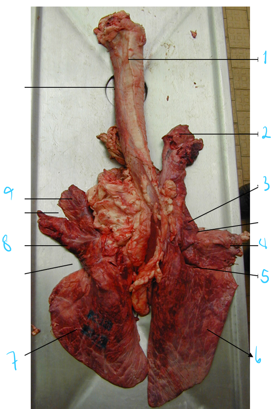 <p>identify these of RU lung. </p>